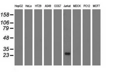 Anti-RIT2 antibody [4B5] used in Western Blot (WB). GTX83711