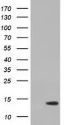 Anti-RIPPLY2 antibody [1B5] used in Western Blot (WB). GTX83713
