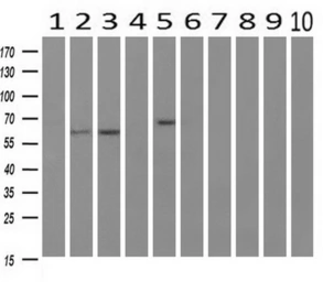 Anti-RIC8A antibody [3G3] used in Western Blot (WB). GTX83714