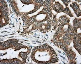 Anti-RDH11 antibody [1B4] used in IHC (Paraffin sections) (IHC-P). GTX83716