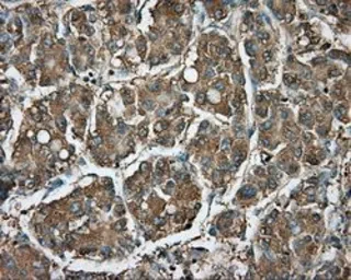 Anti-RDH11 antibody [1B4] used in IHC (Paraffin sections) (IHC-P). GTX83716