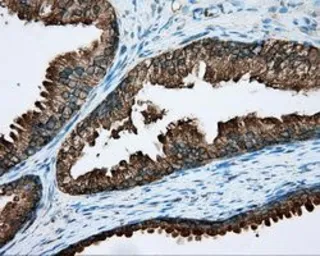 Anti-RDH11 antibody [1B4] used in IHC (Paraffin sections) (IHC-P). GTX83716