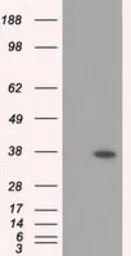 Anti-RDH11 antibody [1B4] used in Western Blot (WB). GTX83716