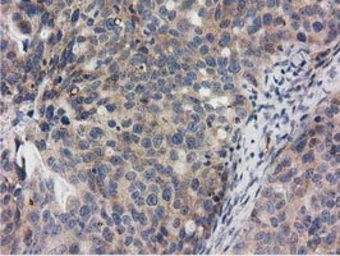 Anti-RASD2 antibody [1G1] used in IHC (Paraffin sections) (IHC-P). GTX83722