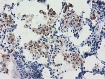 Anti-RASD2 antibody [1G1] used in IHC (Paraffin sections) (IHC-P). GTX83722