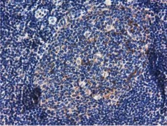 Anti-RASD2 antibody [1G1] used in IHC (Paraffin sections) (IHC-P). GTX83722