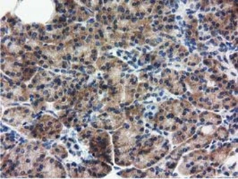 Anti-RASD2 antibody [1G1] used in IHC (Paraffin sections) (IHC-P). GTX83722