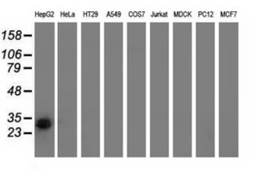 Anti-RASD2 antibody [1D11] used in Western Blot (WB). GTX83723