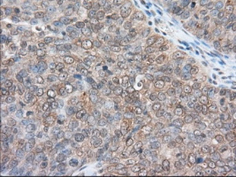 Anti-RANGAP1 antibody [1B4] used in IHC (Paraffin sections) (IHC-P). GTX83725