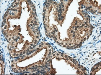 Anti-RANGAP1 antibody [1B4] used in IHC (Paraffin sections) (IHC-P). GTX83725