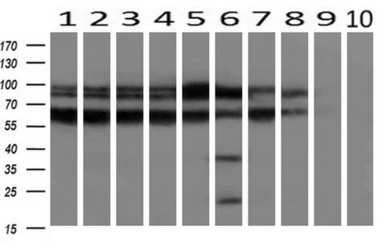 Anti-RANGAP1 antibody [1B4] used in Western Blot (WB). GTX83725