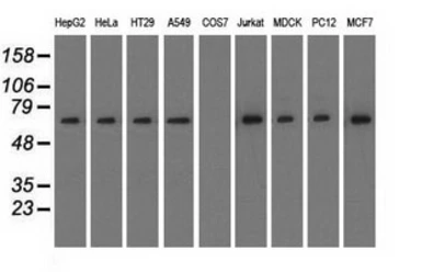 Anti-RANGAP1 antibody [1B4] used in Western Blot (WB). GTX83725