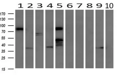 Anti-RALBP1 antibody [6G10] used in Western Blot (WB). GTX83730