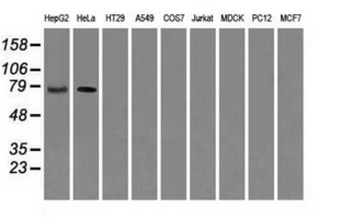 Anti-RALBP1 antibody [6G10] used in Western Blot (WB). GTX83730
