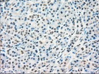 Anti-RAD9A antibody [5D9] used in IHC (Paraffin sections) (IHC-P). GTX83735