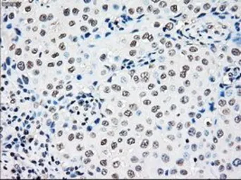 Anti-RAD9A antibody [7B11] used in IHC (Paraffin sections) (IHC-P). GTX83736