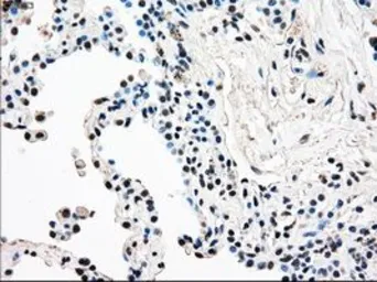 Anti-RAD9A antibody [7B11] used in IHC (Paraffin sections) (IHC-P). GTX83736