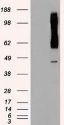 Anti-RAD9A antibody [7B11] used in Western Blot (WB). GTX83736