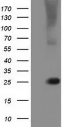 Anti-RABL2A antibody [2G10] used in Western Blot (WB). GTX83737