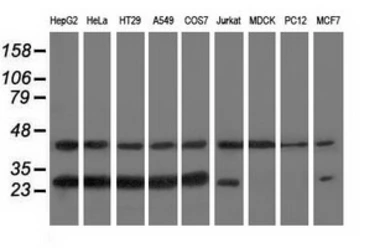 Anti-RABL2A antibody [2G10] used in Western Blot (WB). GTX83737