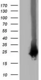 Anti-RABL2A antibody [4A8] used in Western Blot (WB). GTX83738