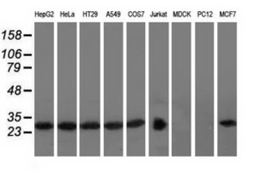 Anti-RABL2A antibody [4A8] used in Western Blot (WB). GTX83738