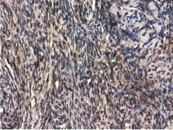 Anti-QPRT antibody [1C10] used in IHC (Paraffin sections) (IHC-P). GTX83743
