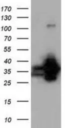 Anti-QPRT antibody [1C10] used in Western Blot (WB). GTX83743