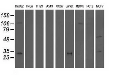 Anti-QPRT antibody [1C10] used in Western Blot (WB). GTX83743