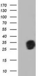 Anti-QPRT antibody [4B4] used in Western Blot (WB). GTX83744