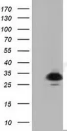 Anti-PYCR2 antibody [2A5] used in Western Blot (WB). GTX83753