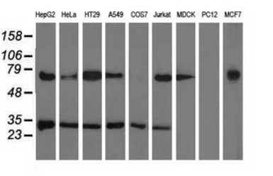 Anti-PYCR2 antibody [2A5] used in Western Blot (WB). GTX83753