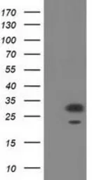 Anti-PYCR2 antibody [2F11] used in Western Blot (WB). GTX83754