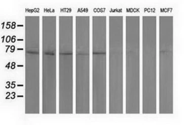 Anti-PUS7 antibody [4A2] used in Western Blot (WB). GTX83755