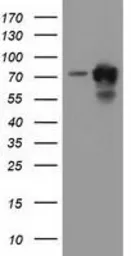 Anti-PUS7 antibody [4H5] used in Western Blot (WB). GTX83756