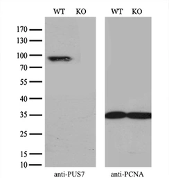 Anti-PUS7 antibody [4C6] used in Western Blot (WB). GTX83757