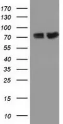 Anti-PUS7 antibody [4C6] used in Western Blot (WB). GTX83757