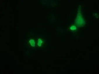 Anti-PUS7 antibody [4C6] used in Immunocytochemistry/ Immunofluorescence (ICC/IF). GTX83757