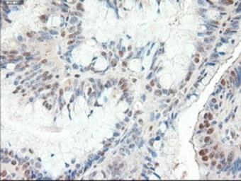 Anti-PTCH1 antibody [5c7] used in IHC (Paraffin sections) (IHC-P). GTX83771
