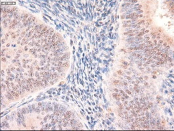 Anti-PTCH1 antibody [5c7] used in IHC (Paraffin sections) (IHC-P). GTX83771