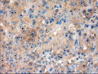 Anti-PTCH1 antibody [5c7] used in IHC (Paraffin sections) (IHC-P). GTX83771