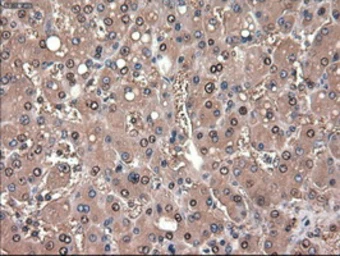 Anti-PTCH1 antibody [5c7] used in IHC (Paraffin sections) (IHC-P). GTX83771