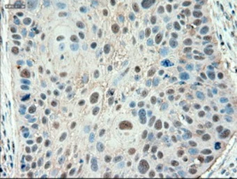 Anti-PTCH1 antibody [5c7] used in IHC (Paraffin sections) (IHC-P). GTX83771