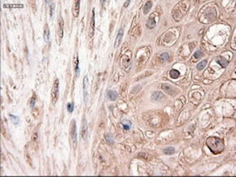 Anti-PTCH1 antibody [5c7] used in IHC (Paraffin sections) (IHC-P). GTX83771