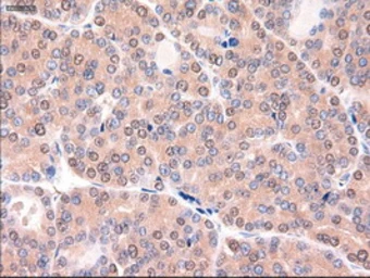 Anti-PTCH1 antibody [5c7] used in IHC (Paraffin sections) (IHC-P). GTX83771
