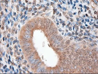 Anti-PTCH1 antibody [5c7] used in IHC (Paraffin sections) (IHC-P). GTX83771
