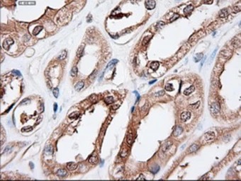Anti-PTCH1 antibody [5c7] used in IHC (Paraffin sections) (IHC-P). GTX83771
