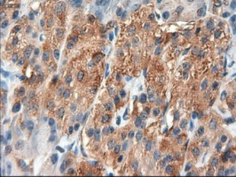 Anti-PTCH1 antibody [5c7] used in IHC (Paraffin sections) (IHC-P). GTX83771