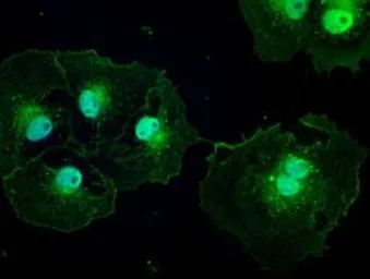 Anti-PTCH1 antibody [5c7] used in Immunocytochemistry/ Immunofluorescence (ICC/IF). GTX83771