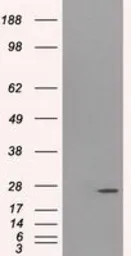 Anti-PSMD10 antibody [3F6] used in Western Blot (WB). GTX83773